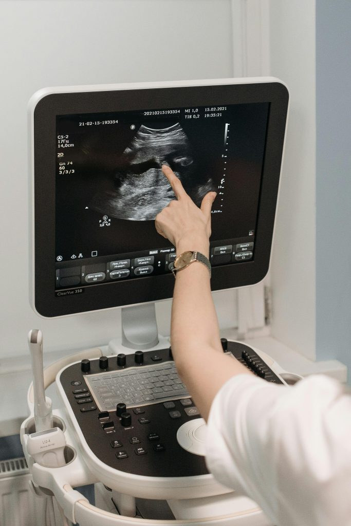 ultrasound untuk ibu mengandung